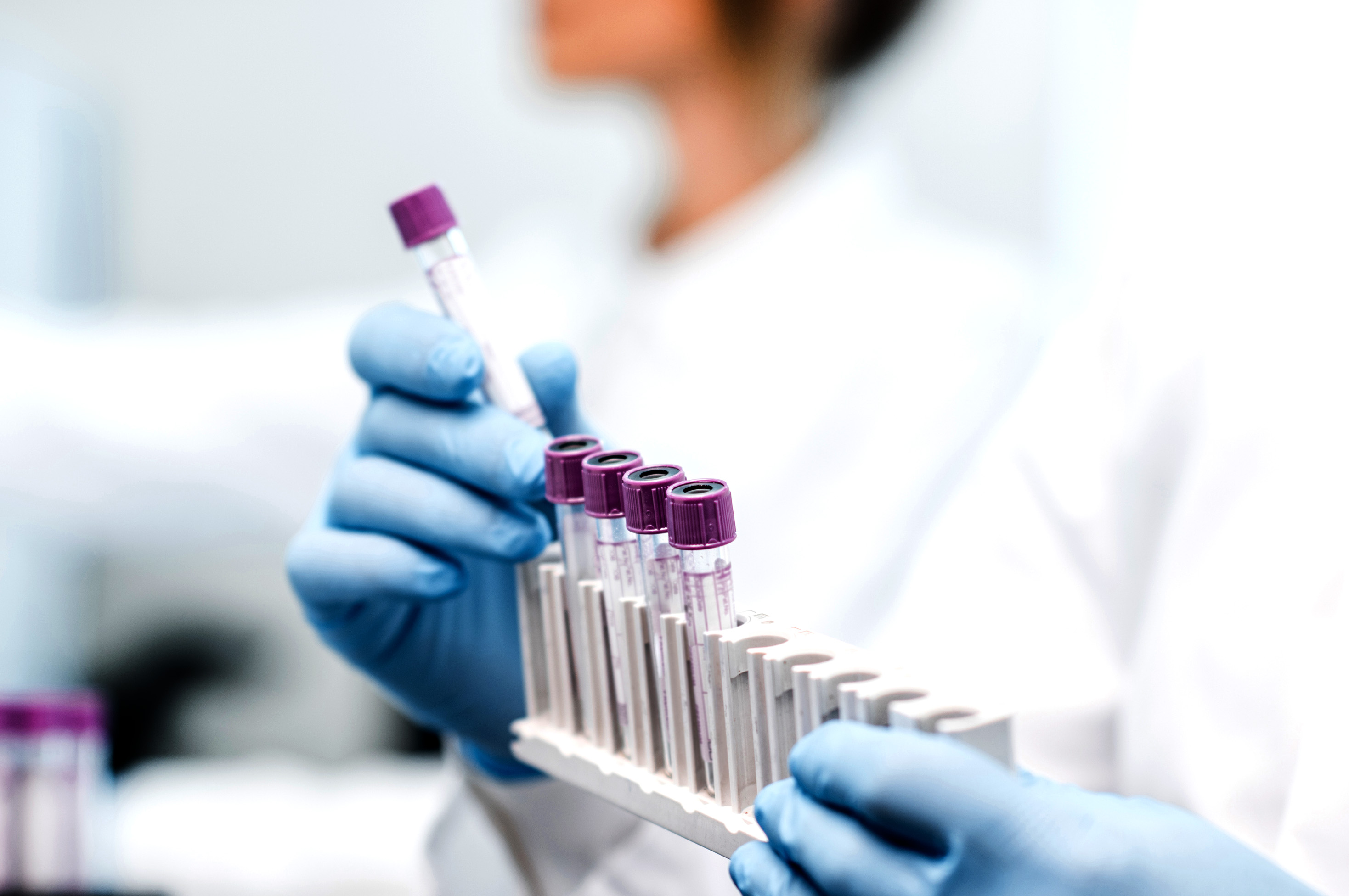 Laboratory assistant putting test tubes into the holder