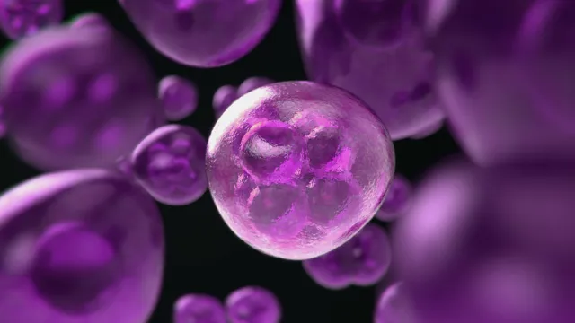 Pancreatic cancer cells