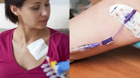 chemotherapy devices PICC and port