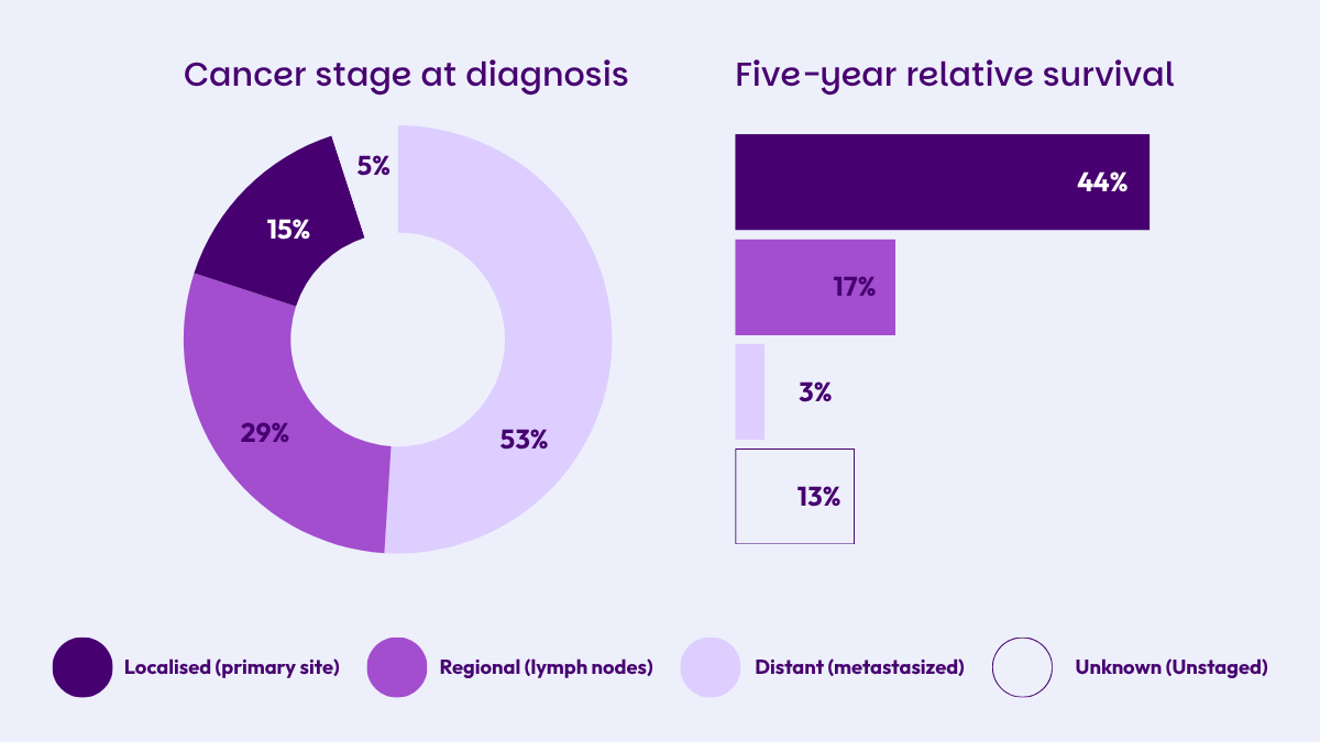 Pancreatic cancer detection stage and five-year relative survival rate